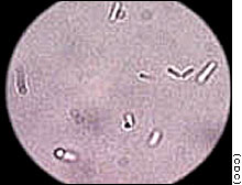botulism